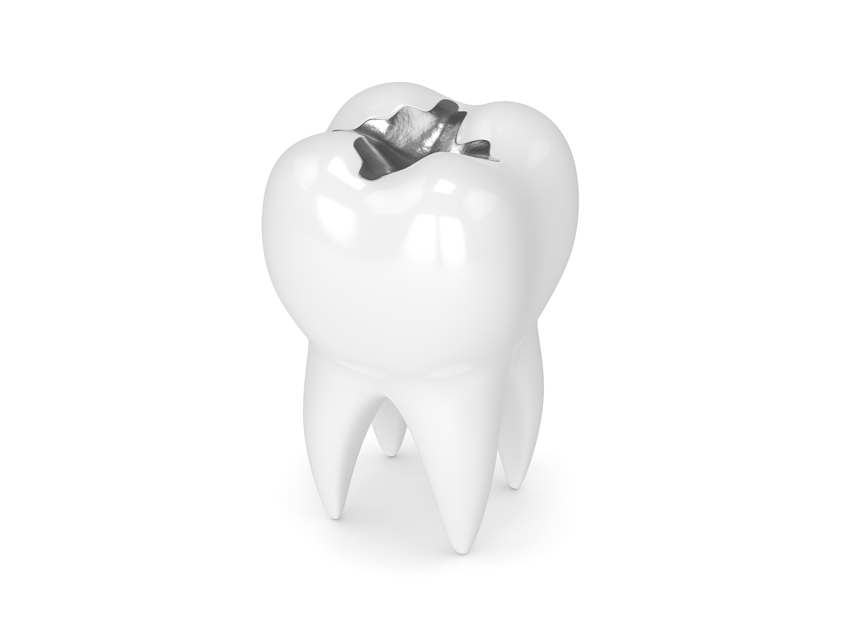 Dentist Fillings Carmarthen Freeman & Rosser Dental & Implant Clinic